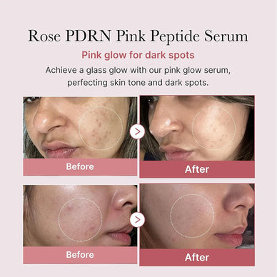 Reveal Your Radiance and Embrace Youthful Skin!